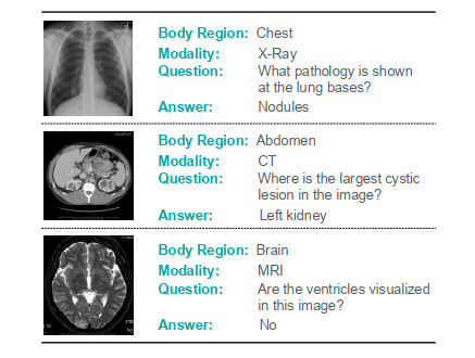 Medical VQA